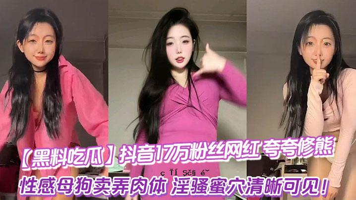 黑色食品17万粒，17万粒，17万粒，17万粒，17万粒，17万粒，17万粒，17万粒，17万粒。